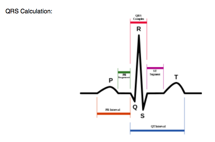 QRS Calculation